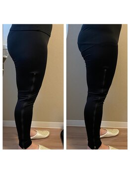 ヨサパーク カルム(YOSA PARK)/Wリンパマッサージでお尻が