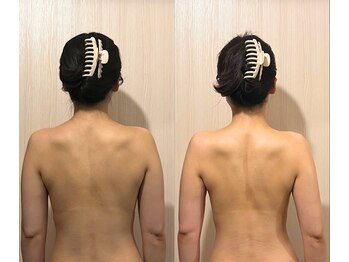 クララ(clara)/クララシェイプボディ