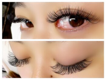 アアルズ(R’s)/