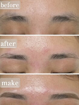 ビアンカ(Bianca)の写真/【大分市賀来】理想の美眉をプロデュース!プライベートサロンBiancaで「垢抜け」を叶えるアイブロウに♪