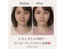 ブリリアントスマイルの雰囲気（レモンボトルで二重顎・フェイスラインをスッキリ小顔へ）