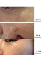 メディカルエース(MedicalAce)/スポット