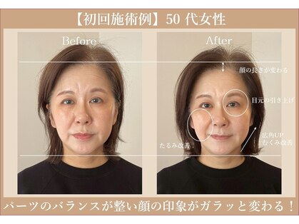 ラ アクサル(la.akthar)の写真