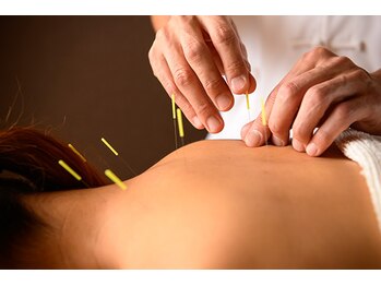 ソレイユ麻布鍼灸整体院の写真/[完全個室/麻布十番徒歩3分]美容鍼で肌質改善・小顔ケア/辛い首肩のコリ・不眠改善◎鍼初心者の方も大歓迎