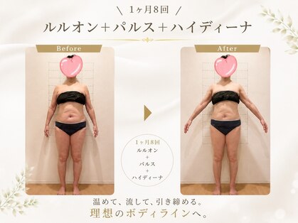 ヨサパーク エスポワール 三木店(YOSAPARK Espoir)の写真