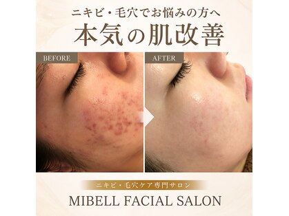 ミベル フェイシャルサロン(MIBELL FACIAL SALON)の写真