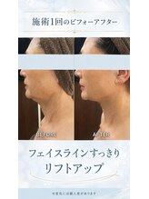 リラクゼーションサロン ラキ(laki)/インコアシェイプ