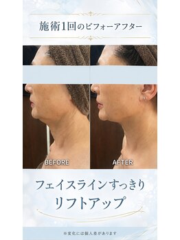 リラクゼーションサロン ラキ(laki)/インコアシェイプ