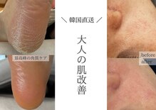 フットミー(foot mii)