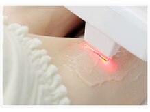 メディカルサロン フィオレ(fiore)/ 【パワー美肌脱毛】