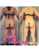 ボディエステティック アクアオーラ 富山店/