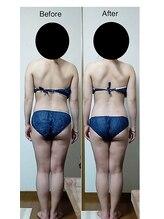 ナチュラルライフ(Natural Life)/施術のbefore after．2