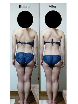 ナチュラルライフ(Natural Life)/施術のbefore after．2