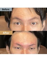 眉毛ハウス 吉祥寺店(眉毛HOUSE)/お客様の施術例(吉祥寺/東京)