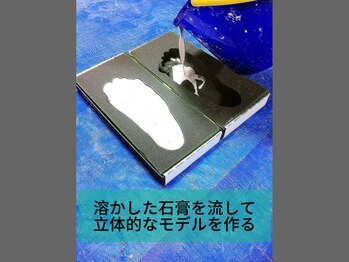 オーサポート(O-support)/石膏流し