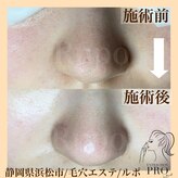 ルポ