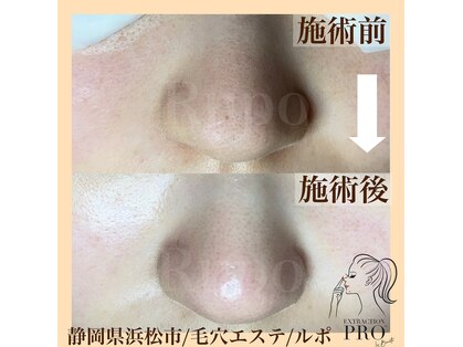 ルポの写真