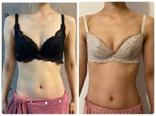 ハイファイブ(Hi-Five)/バストアップ/施術12回