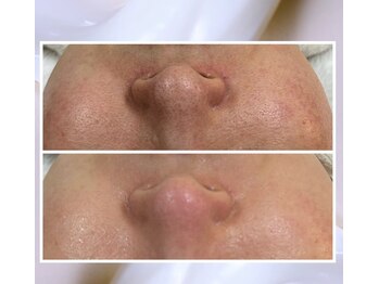 サロンド ユニバース(salon de universe)/