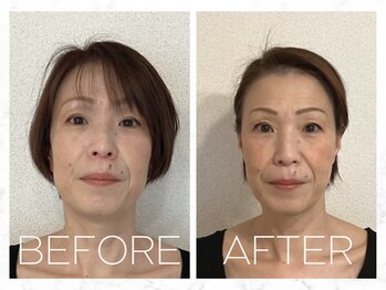 コノハナ(conohana)/姿勢も良くなる小顔&ヘッドスパ