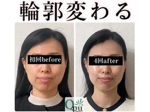 キュープ 広島店(Qpu)の雰囲気（1対1で、丁寧に小顔頭蓋骨矯正いたします。）