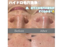 エスト(este.)の雰囲気（毛穴スペシャルケア！！リピーター様続出中！）