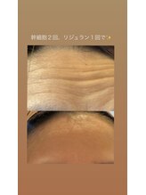 ルルアス(LuLu AS)/