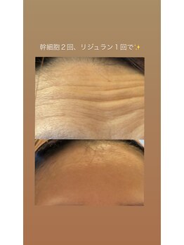 ルルアス(LuLu AS)/