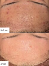 ミエル 恵比寿店(Miel)/リアボーテトリートメント