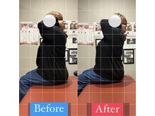 ナオル整体 宮崎院(NAORU整体)/40代女性施術事例【姿勢改善】