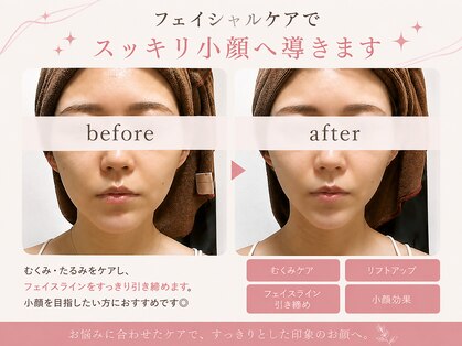 フォルトゥナ(Fortuna)の写真