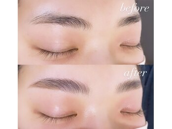 リノ(Lino)/HBL(ハリウッドブロウリフト)