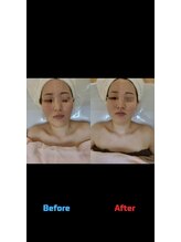 ティックサロン(tic.salon)/レストセルトリートメント前後☆