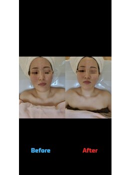 ティックサロン(tic.salon)/レストセルトリートメント前後☆