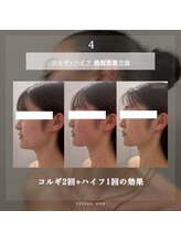 ヴィヴィアン 太田川店(Vivian)/全身のストレッチでデトックス