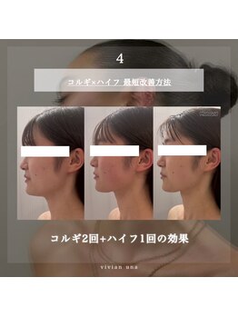 ヴィヴィアン 太田川店(Vivian)/全身のストレッチでデトックス