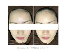 レーヴ 名古屋金山(Reve)の雰囲気（肌荒れや乾燥の季節には、肌バリア強化して潤い素肌の土台作り♪）