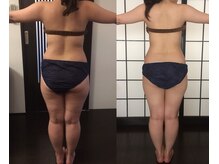 スリーピングレディ(Sleeping Lady)/短期集中インディバ