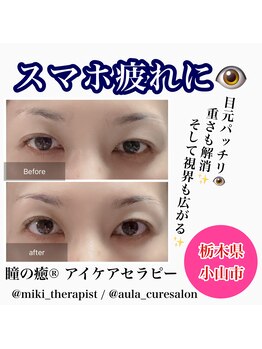 アウラ(Aula)/瞳の癒アイケアセラピー