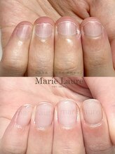マリーロール 淀屋橋本店(Marie Laure)/自爪育成/深爪矯正/ネイルケア