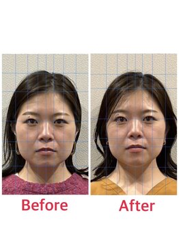 日進町整体院/30代女性　3回目からの効果実感