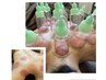 男のカッピング（背中or足背面/お腹or足表面）　20分　3500円