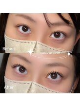 ラムンコット(Ramm//cot.)/エクステパーマ#取手市