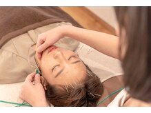 ハルユイ(haruyui)/3 美容鍼施術