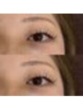 バニーアイズ 天神(Bunny eyes TENJIN)/フラット100本