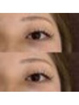 バニーアイズ 天神(Bunny eyes TENJIN)/フラット100本