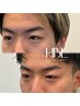 【人気No.1♪リピーター様限定】 HBL 7700円