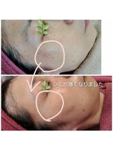 エタニティ(Eternity)/若見え肌へ♪