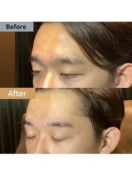 眉毛ハウス 吉祥寺店(眉毛HOUSE)/お客様の施術例(吉祥寺/東京)