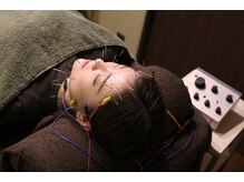 オリエントセラピー(ORIENT THERAPY)の雰囲気（即効・確実性に優れる電気美容鍼。今すぐを求められる方は是非。）